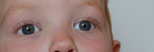 IMG_0326 both eyes.jpg