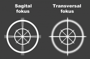 Sagital fokus.gif